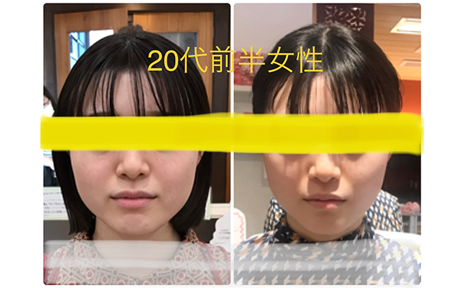 小顔矯正コルギチケット×10回 体験チケット 美容 