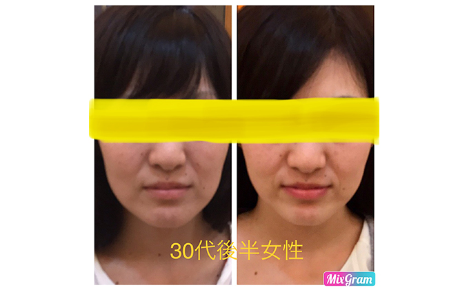 小顔矯正コルギチケット×10回 体験チケット 美容 