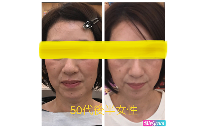 小顔矯正コルギチケット×10回 体験チケット 美容 