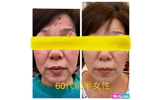 小顔矯正コルギチケット×10回 体験チケット 美容 